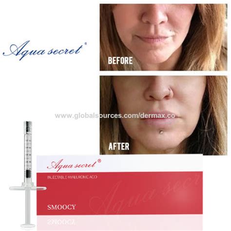 Buy Wholesale China Aqua Secret Customize Dermal Filler Smoocy