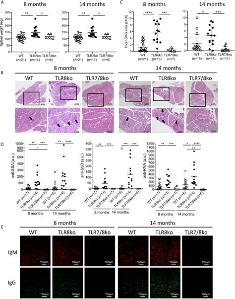 Frontiers Tlr Signaling Drives The Development Of Sj Grens Syndrome