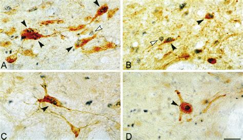 Photomicrographs Of Sections Dual Immunostained For C Fos Blue