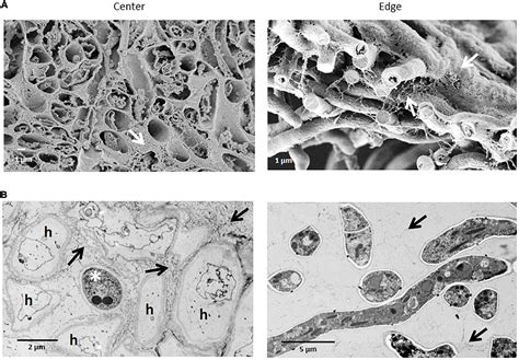 Frontiers Colony Growth And Biofilm Formation Of Aspergillus Niger Under Simulated Microgravity