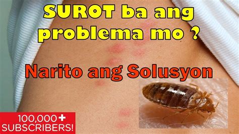 Mga Paraan Para Maubos Ang Surot Sa Bahay YouTube