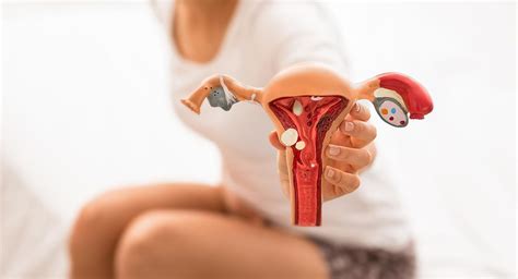 Endometriosis de qué trata la enfermedad de la hija del cazador de