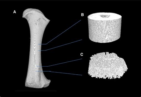 Femoral bone regions of interest are: A ) whole femoral bone, B ...