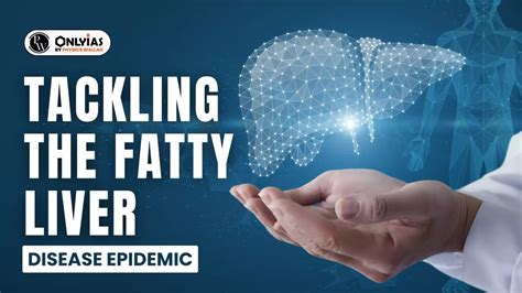 Tackling The Fatty Liver Disease Epidemic Pwonlyias