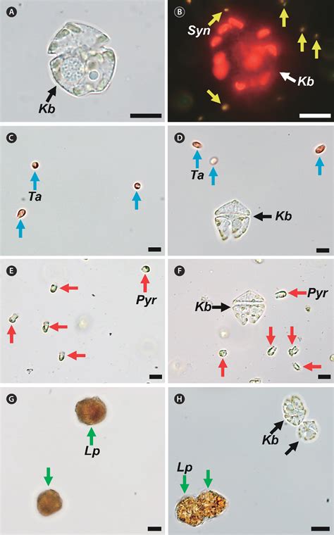 Figure 1 From Lack Of Mixotrophy In Three Karenia Species And The Prey