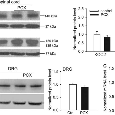 Paclitaxel Treatment Increases Nkcc But Not Kcc Protein Levels In