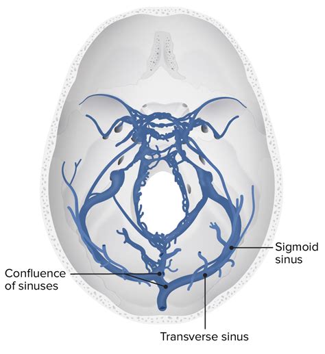 Cerebral Venous Thrombosis Concise Medical Knowledge