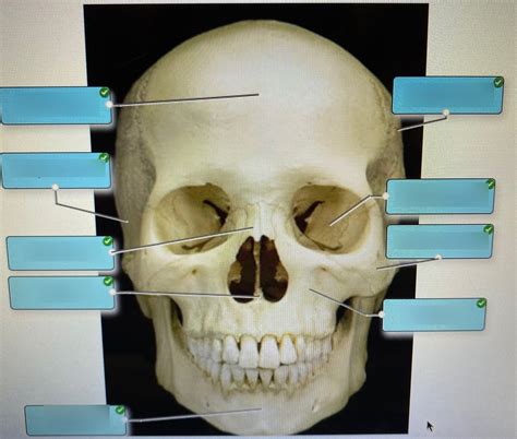 Label Bones Of The Anterior Skull Diagram Quizlet