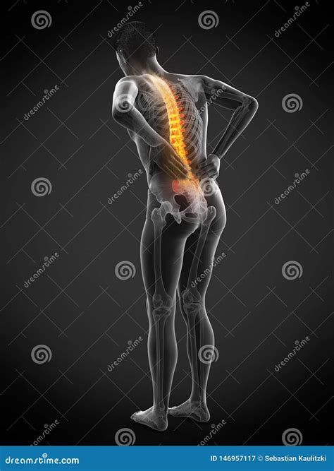 A Man Having Acute Back Pain Royalty-Free Illustration | CartoonDealer
