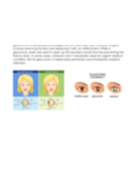 SOLUTION: Difference between cataracts and glaucoma - Studypool