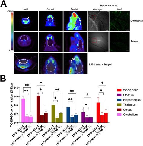 Imaging Oxidative Stress In The LPS Induced Neuroinflammation Mouse