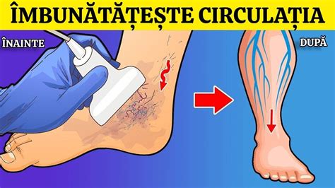 10 MODALITĂȚI DE A ÎMBUNĂTĂȚI INSTANTANEU CIRCULAȚIA SANGUINĂ ÎN