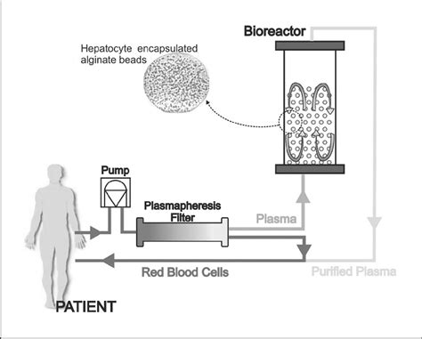 The Concept Of Fluidized Bed Bioartificial Liver The General