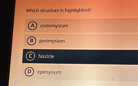 Solved Which structure is | Chegg.com