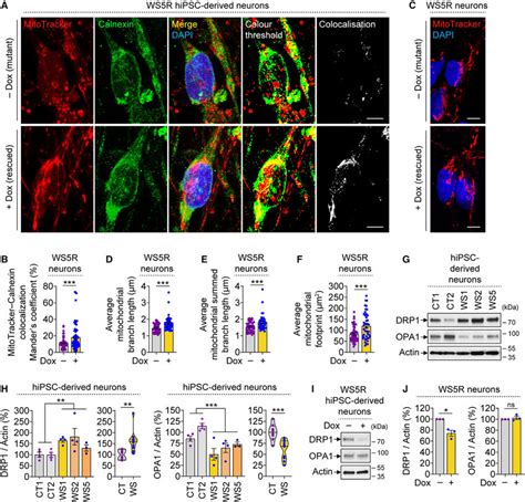 Increase In MAMs And Mitochondrial Branch Length Upon WFS1 Restoration