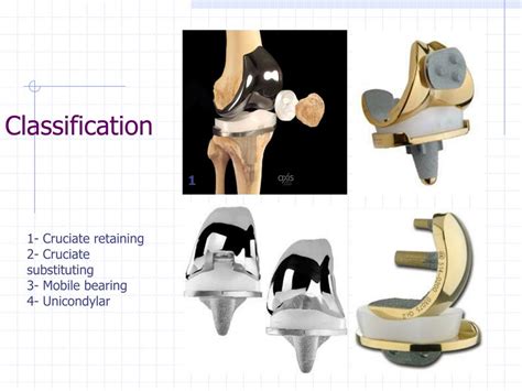 Ppt Total Knee Arthroplasty Tka Total Knee Replacement Tkr