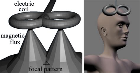 transcranial magnetic stimulation tms equipment