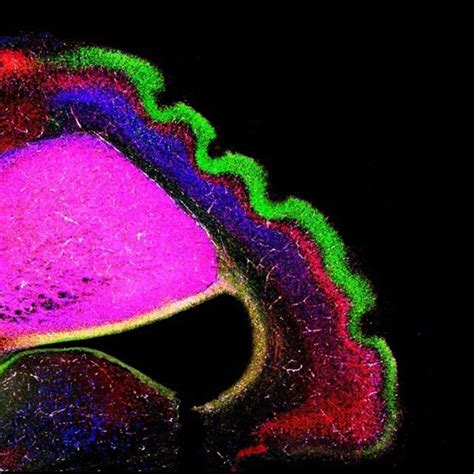 cortical folding news research tags articles neuroscience news