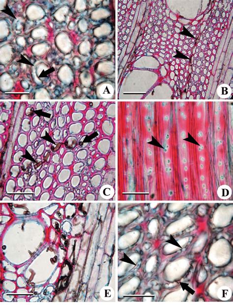 Transverse A C E F And Tangential Longitudinal D View Of Infected Download Scientific