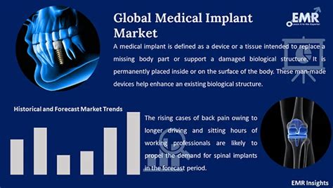 Medical Implant Market Size Share Growth Research 2034