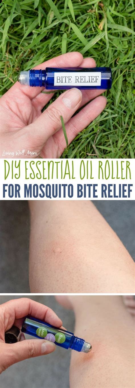 This Easy All Natural Remedy For Mosquito Bite Relief Is A Simple DIY