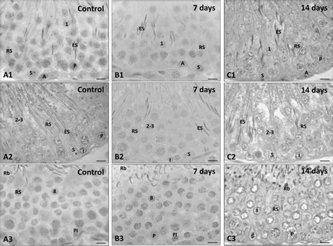 Testicular Cross Sections Of The Seminiferous Tubules In Control