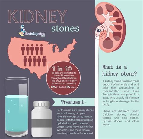 Types Of Kidney Stones