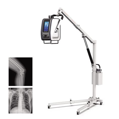 Radiology Equipment Xray 3 5kw Portable High Frequency X Ray Machine X