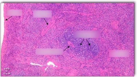 Spleen Histology Diagram Quizlet