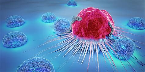 Researchers Identify How To Prevent Cancer Metastases University Of Basel