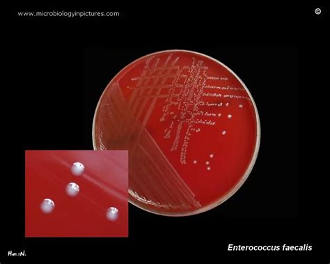 Enterococcus Faecalis Gram Stain