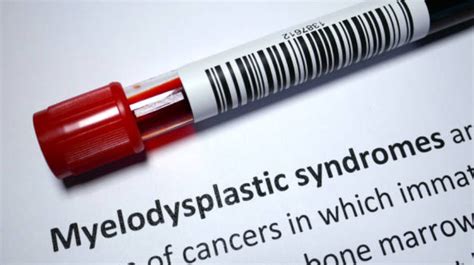 Myelodysplastic Syndrome (MDS) Symptoms, Signs, Causes, And Treatments