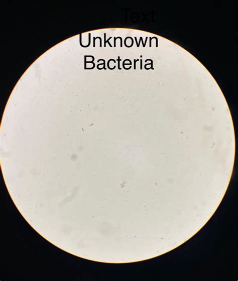 Solved I had a gram stain test, there are unknown bacterias | Chegg.com