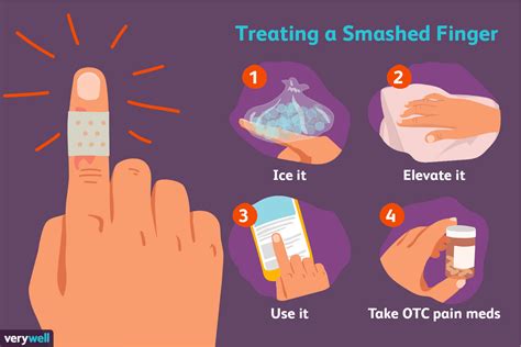 How To Treat A Smashed Finger