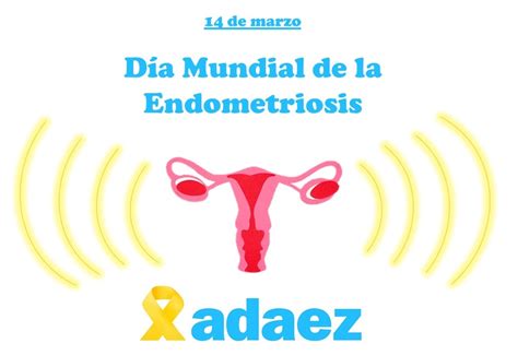 De Marzo D A Mundial De La Endometriosis Adaena