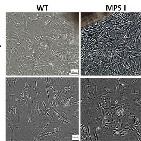 Morphology Of Wild Type WT And Mucopolysaccharidosis I MPS I Murine