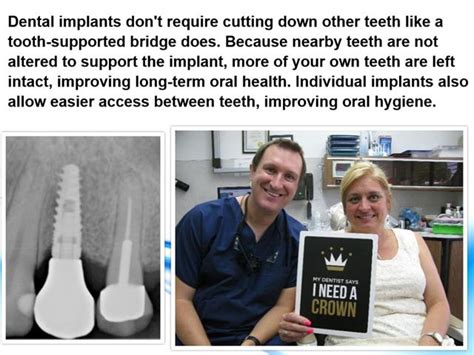 What Is A Dental Implant Dr Michael Nugent