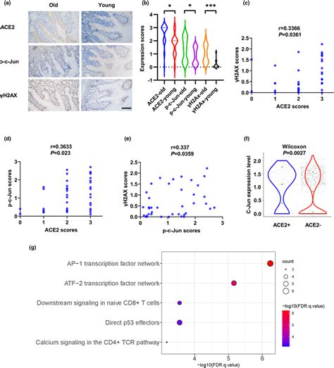 ACE2 correlates positively with pcJun and γH2AX in human tissues a