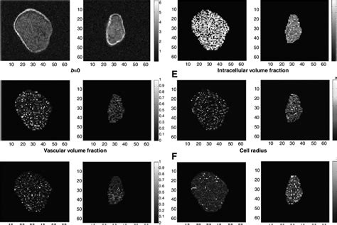 Microstructure Parameter Maps In The Central Slice Through Two Example