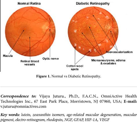 Figure From Lutein And Zeaxanthin Isomers L Zi Protect Retinal