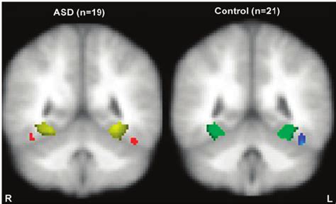 Functional Localization Of Faces And Houses In The Fusiform Gyrus Red