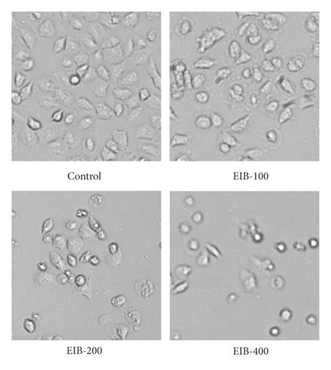 Eib Inhibited The Growth Of Smmc 7721 Cells A Cell Viability Of Download Scientific Diagram