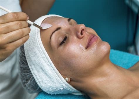 How To Care For Your Skin Before And After A Chemical Peel