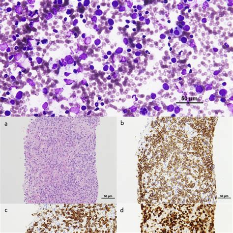 Representative Touch Smear Cytology Of Rapid Onsite Evaluation ROSE