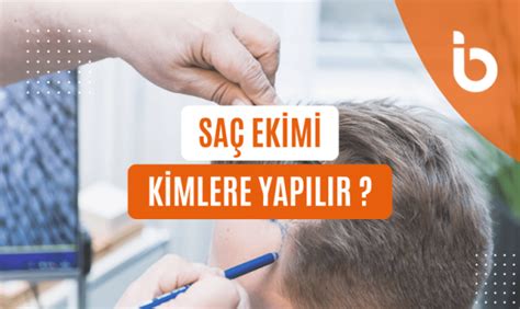 Saç ekimi kimlere yapılır Safe Bari Health