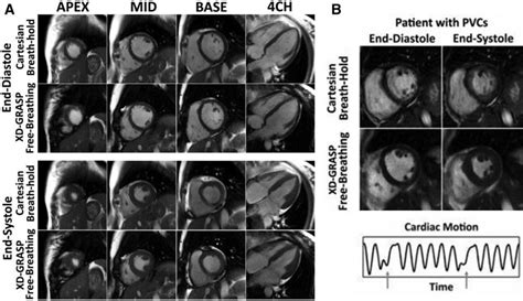 Recent Advances In Cardiovascular Magnetic Resonance Circulation