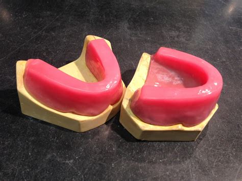 Occlusal Rims Paulina Zarlok S Eportfolio