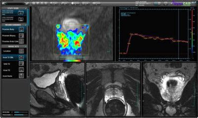 MRT Software MeVis Medical Solutions AG Diagnose Ultraschall