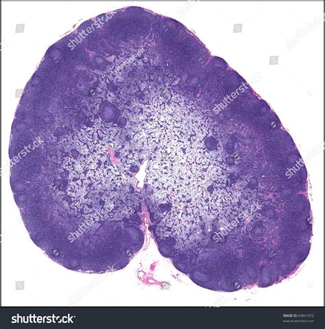 Lymph Node Histology Diagram