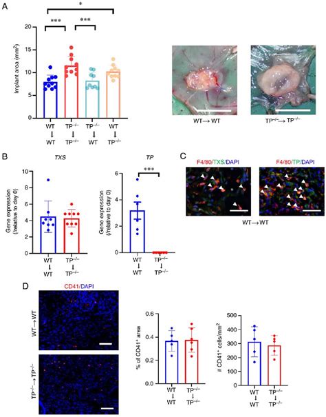 Figure 1 From Inhibition Of TP Signaling Promotes Endometriosis Growth